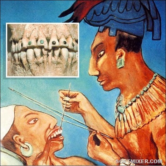 Как лечили зубы наши предки